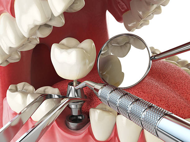 Best Emergency Treatment for Toothache in Cadiz, OH
